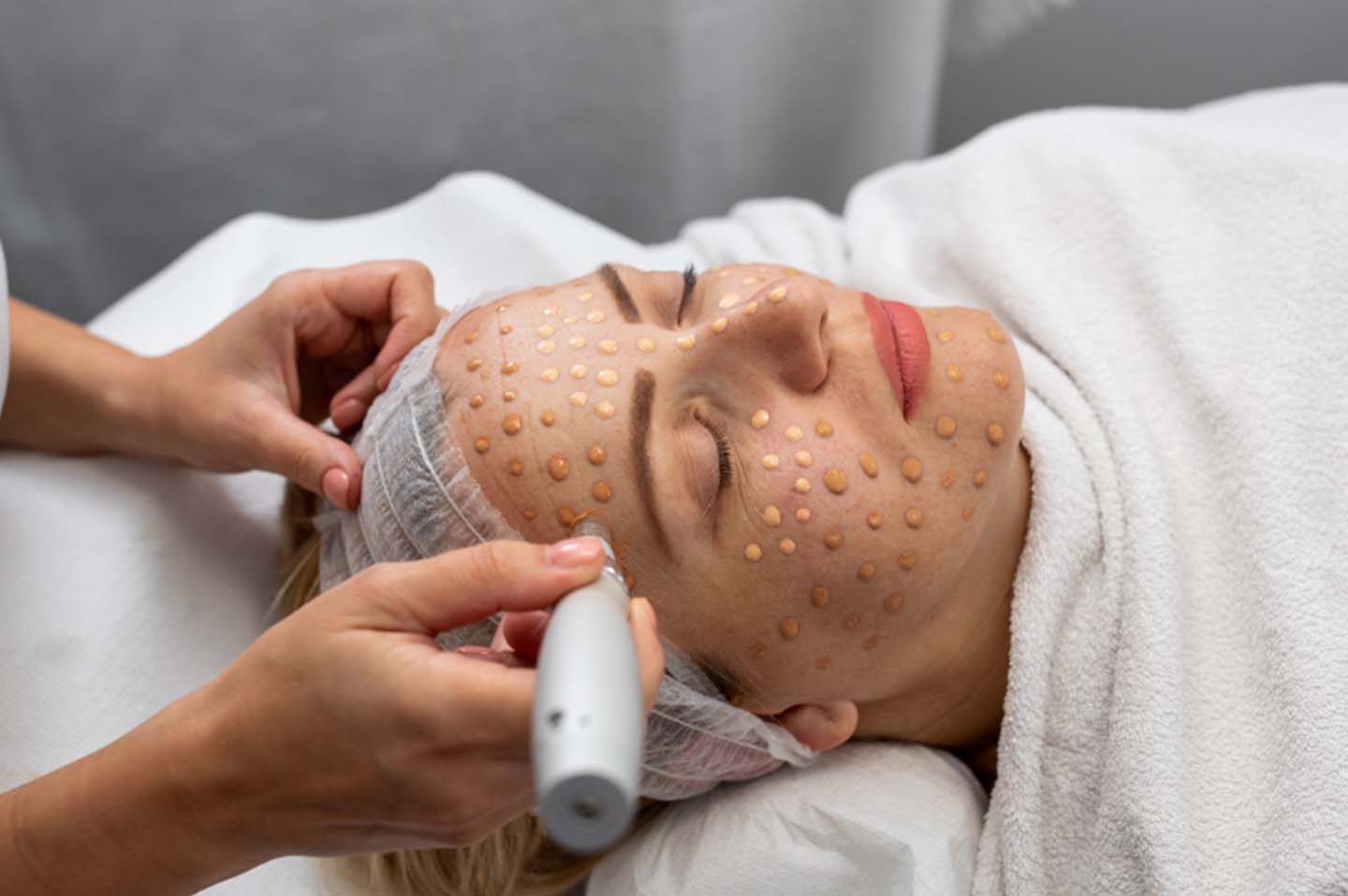 Elixir-Wellness-Center-BB Glow-Treatment