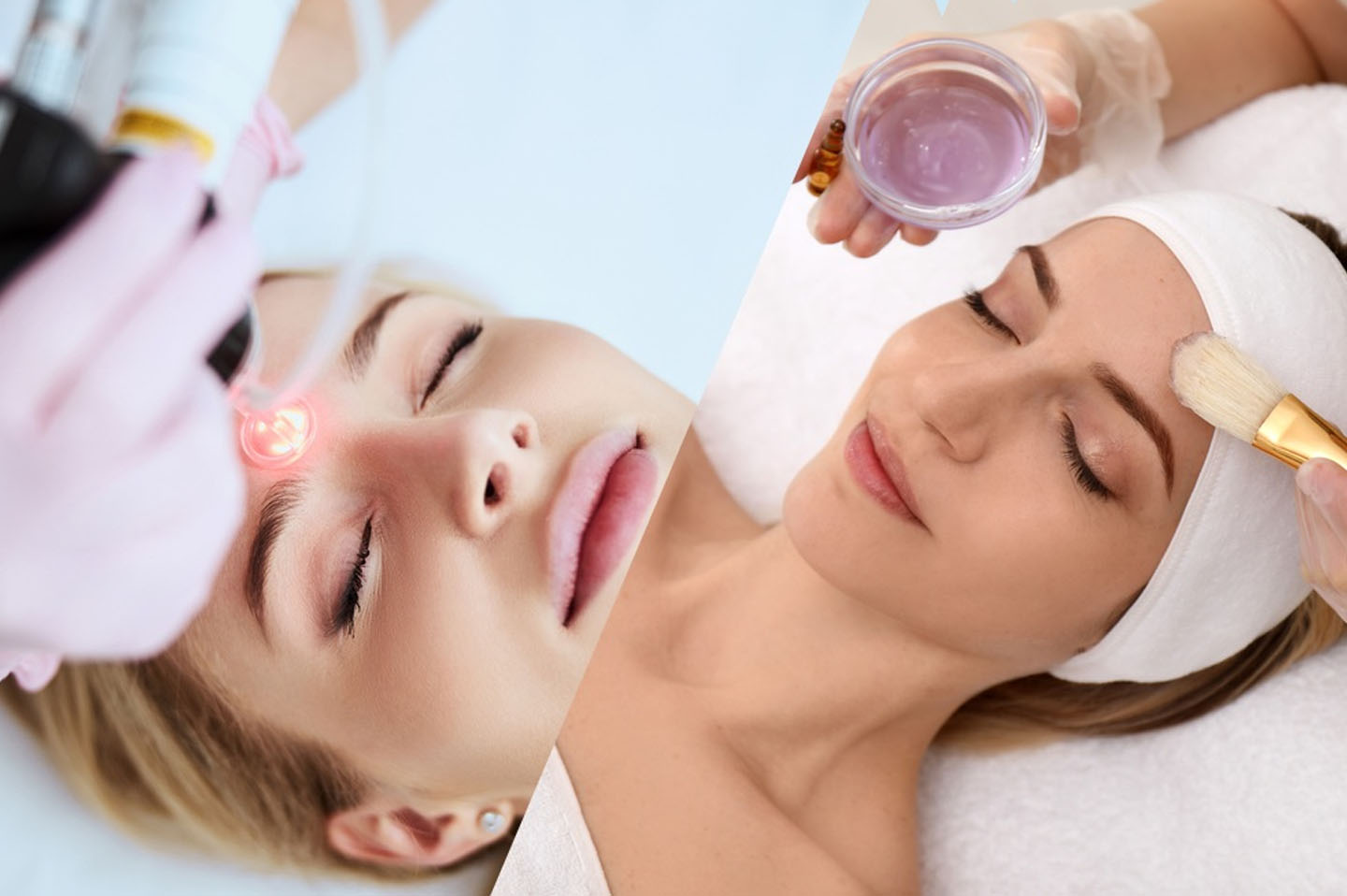 Elixir-Wellness-Center-Chemical-peel-treatment